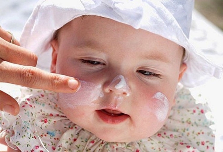 Lo lắng thường gặp khi trẻ bị eczema